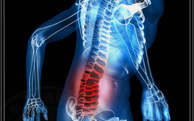 Dor lombar crônica pode ter a maconha como alternativa aos opioides