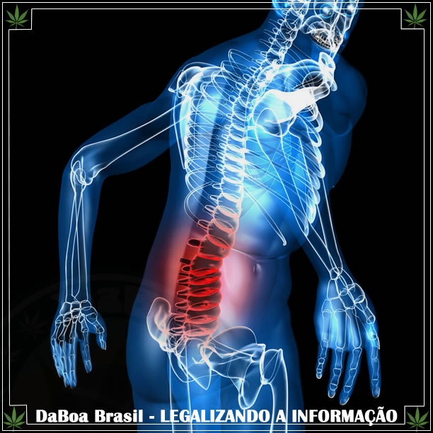 Dor lombar crônica pode ter a maconha como alternativa aos opioides