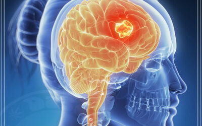 Maconha testada como possível tratamento para o tumor cerebral