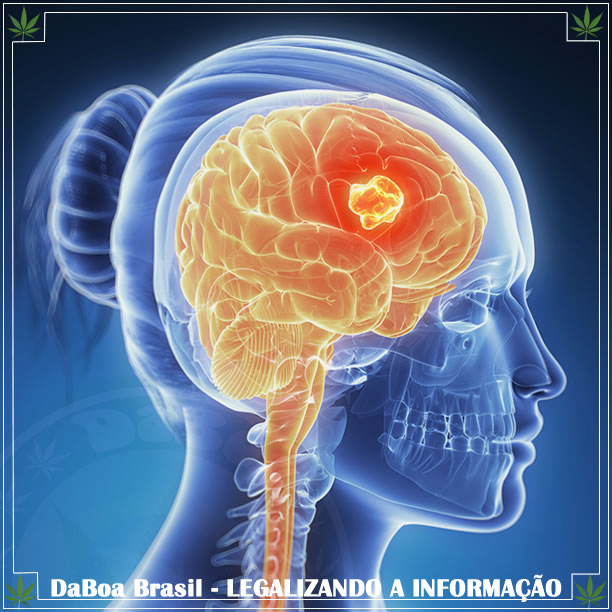 Maconha testada como possível tratamento para o tumor cerebral