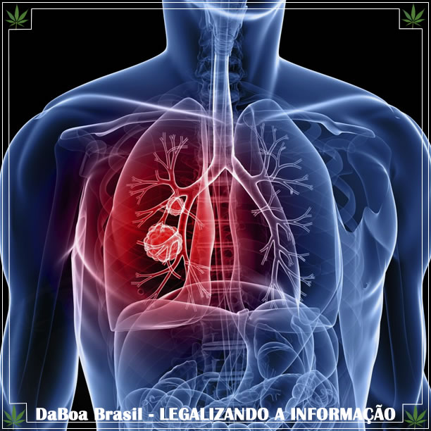 Maconha reduz o câncer de pulmão em 50%, segundo Harvard